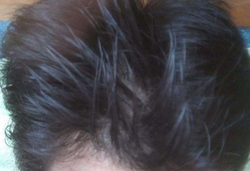 진짜죽고싶습니다..