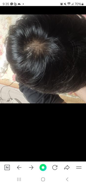 약먹기전