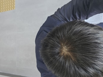 약10개월차