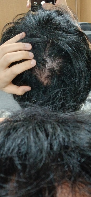 추가수정 : 극복했습니다. 감사합니다. (극복 전)