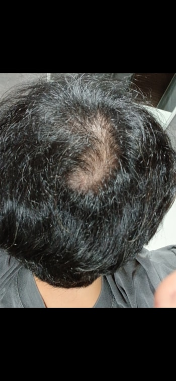 2. 현실부정기(8월 4일)