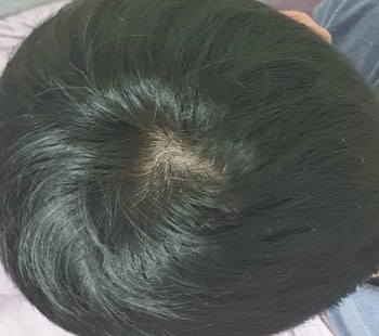 정수리 2021년 1월