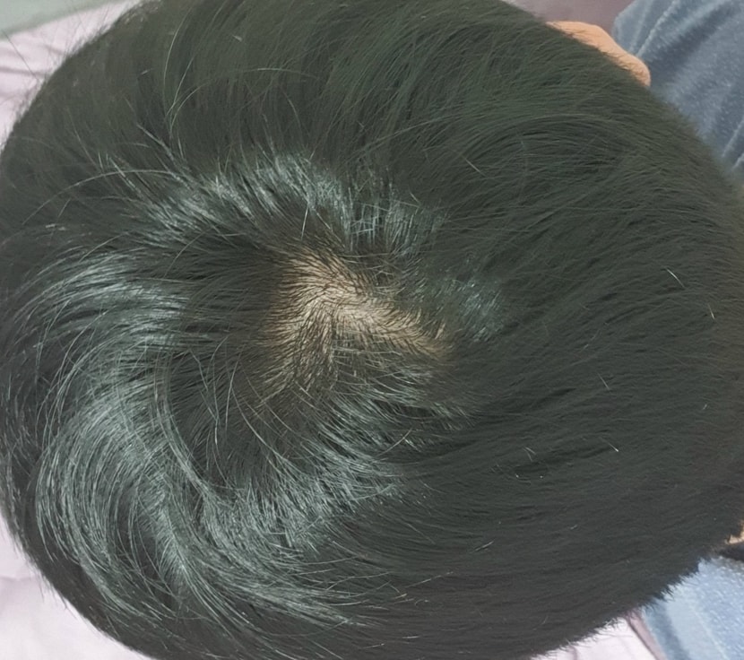 정수리 2021년 1월