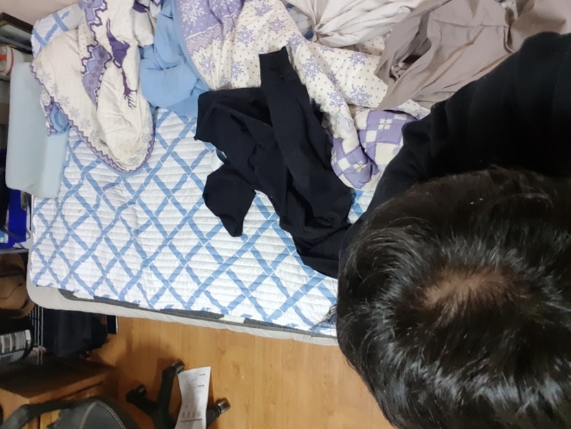 이게 먹고나서 20일차 입니다.