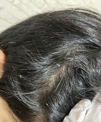 머리에 요론식으로 붙었습니다