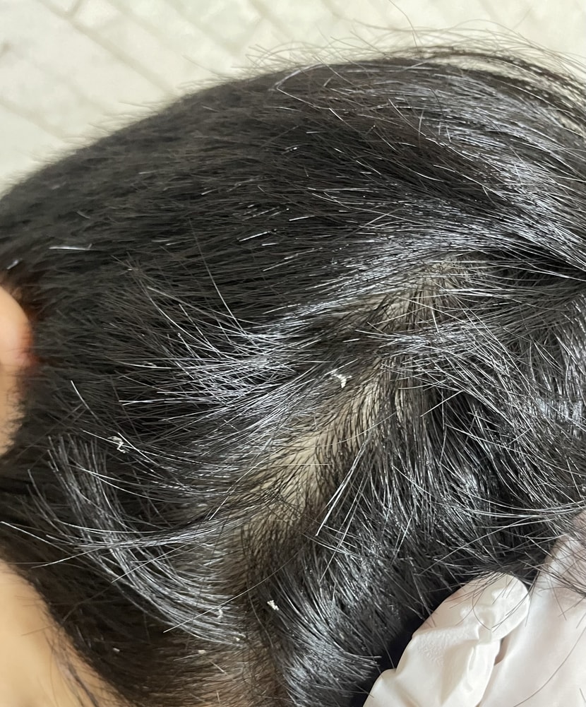 머리에 요론식으로 붙었습니다