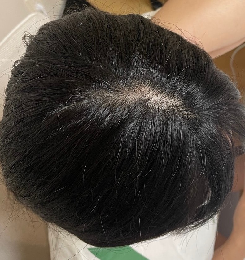 사용 후 정수리 부분
