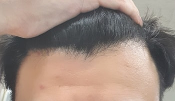 pro
