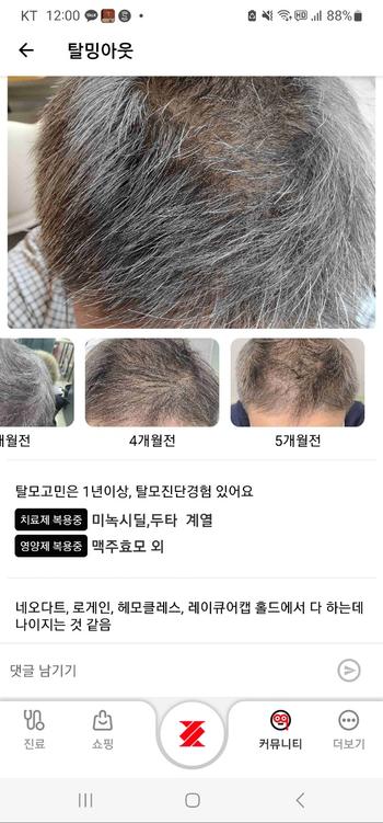 5개월 전 후 