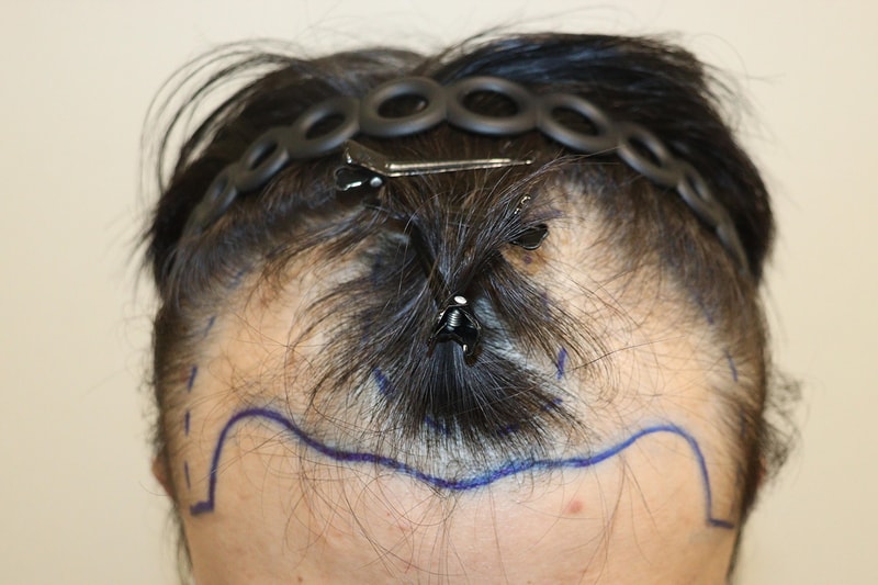 드디어 1년차에 극복해냈습니다