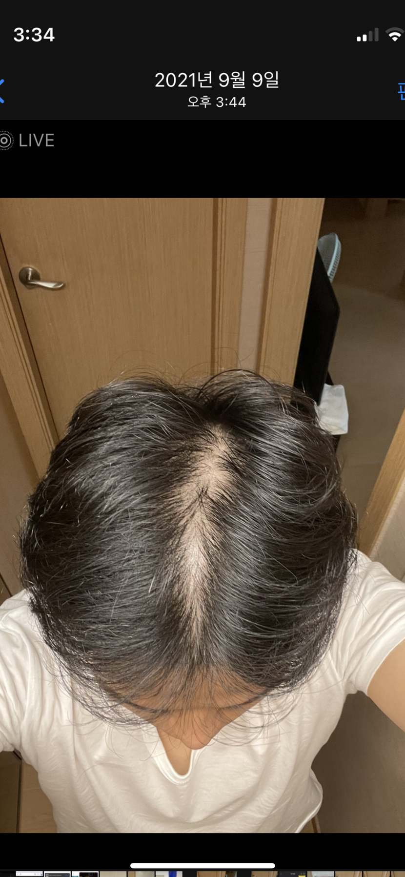 &lt;복용 한 달즈음&gt;