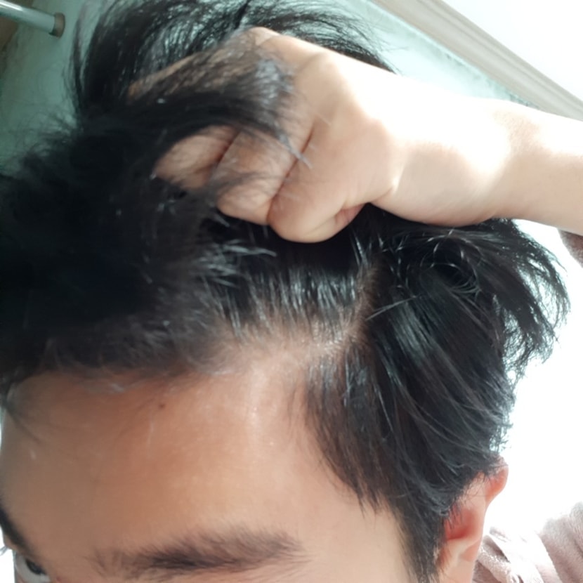 M자 왼쪽