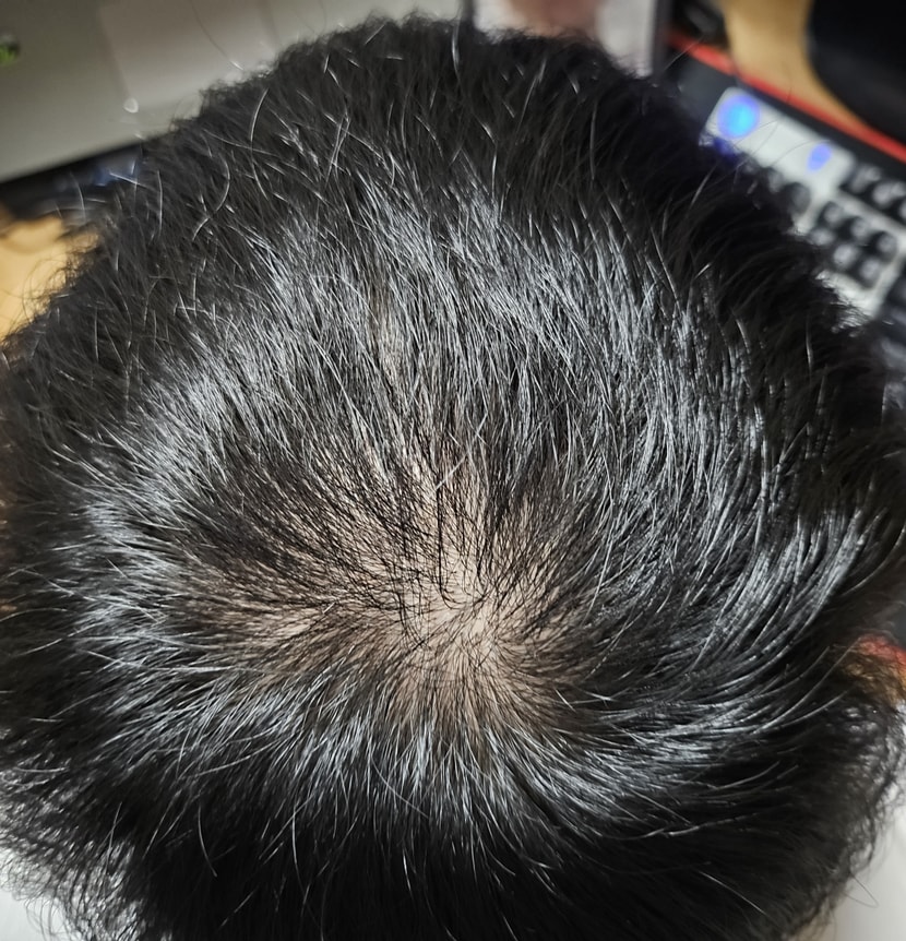 100일차