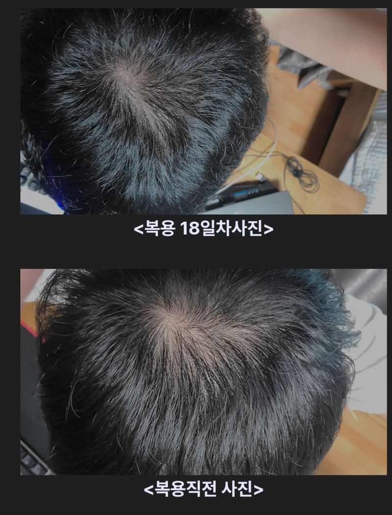 피나온 100일차 입니다