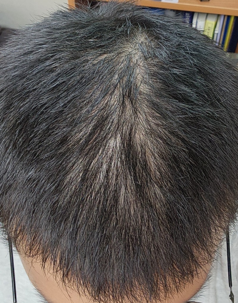 이런 머리는 어떻게 해야하나요..