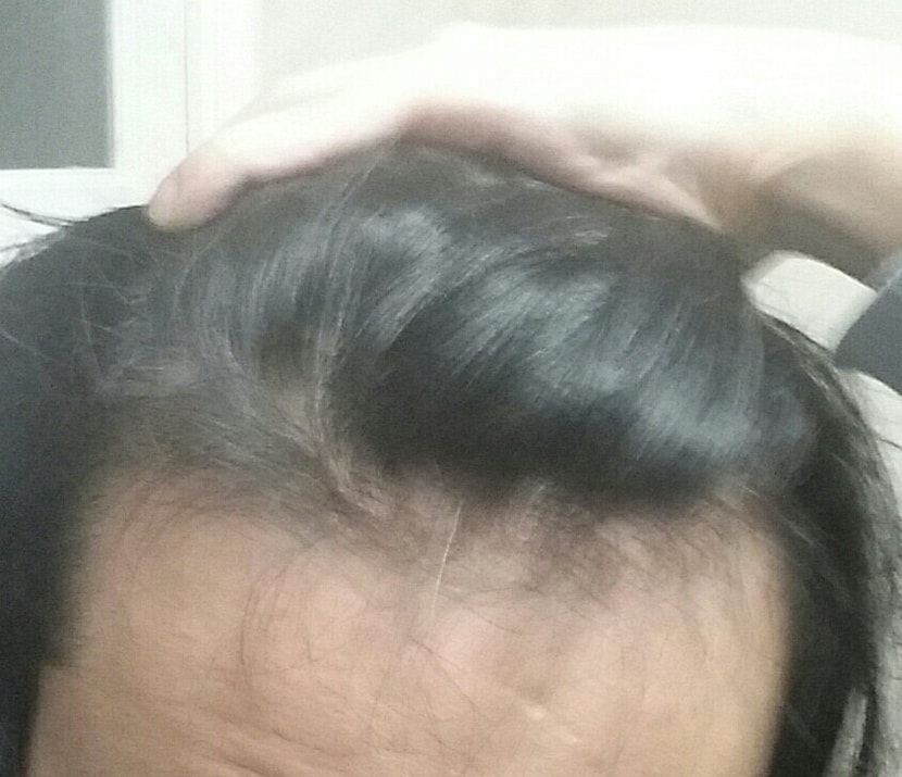전체 사진