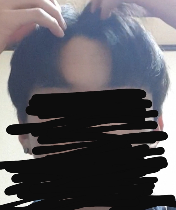 평소 머리