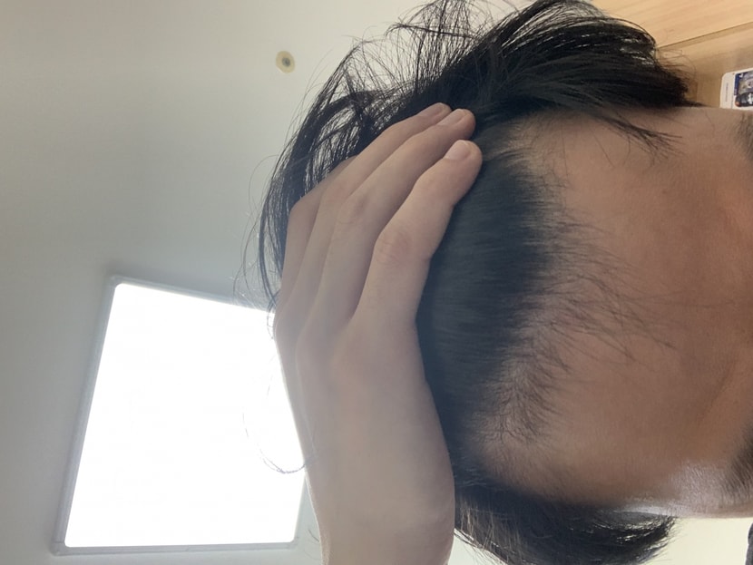 약복용 6개월 현재 입니다 