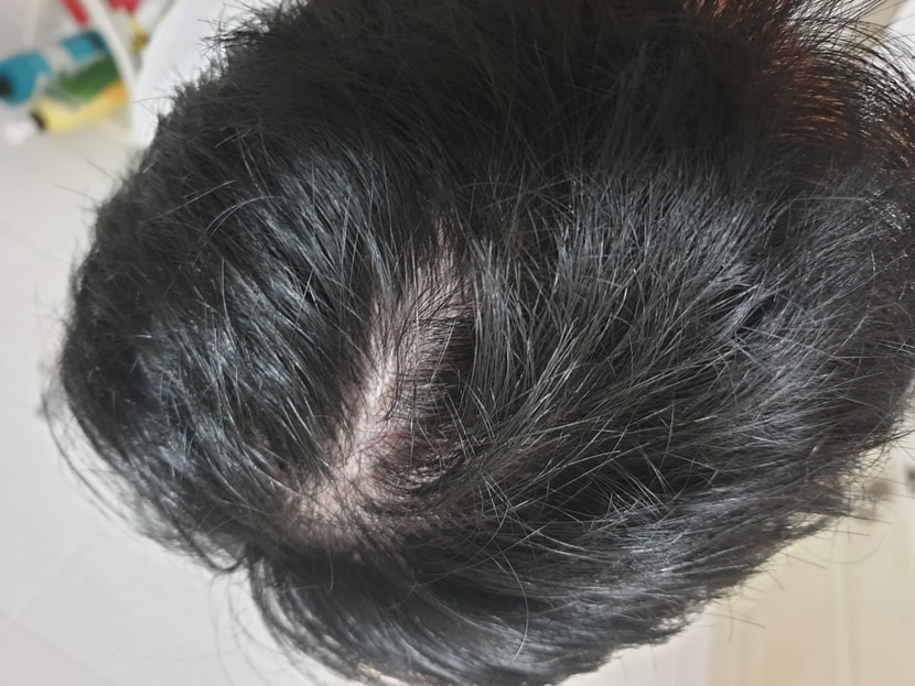 정수리