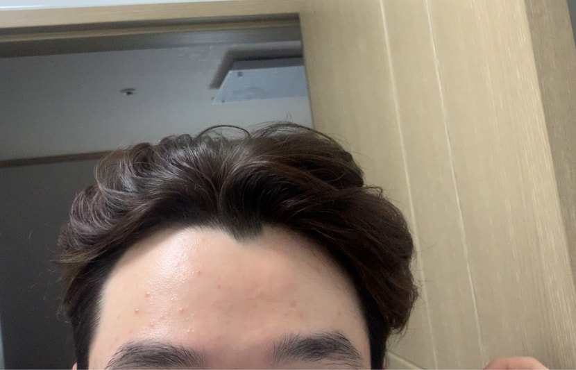 뾰족한거. 원숭이 같아요