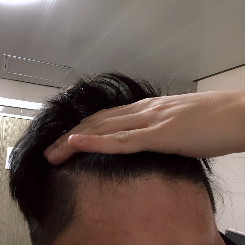 왼쪽