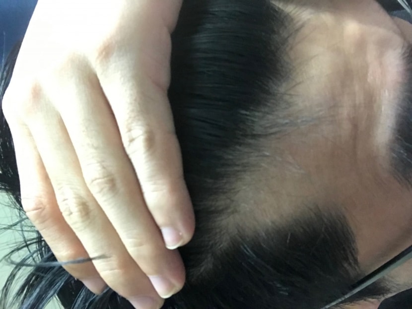 M자라인