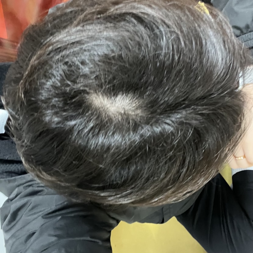3개월 복용상태
