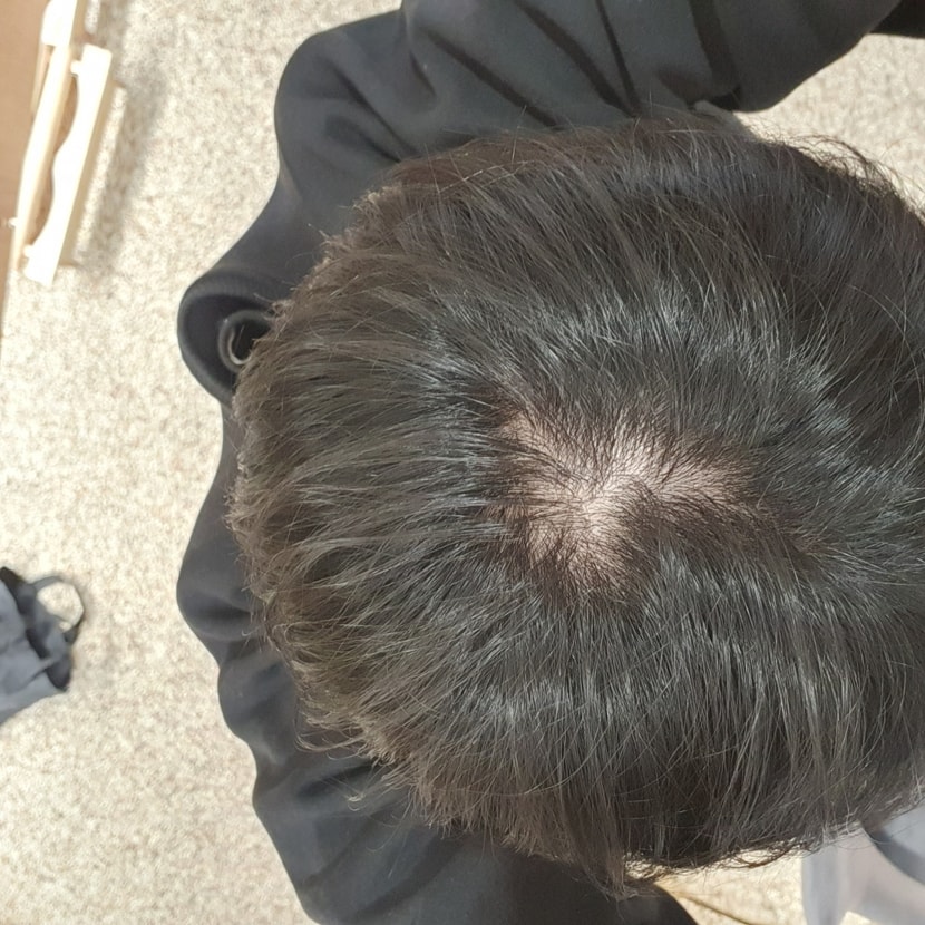 정수리 ,, 