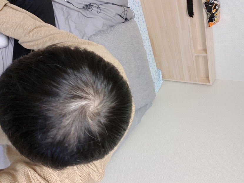 복용 1개월