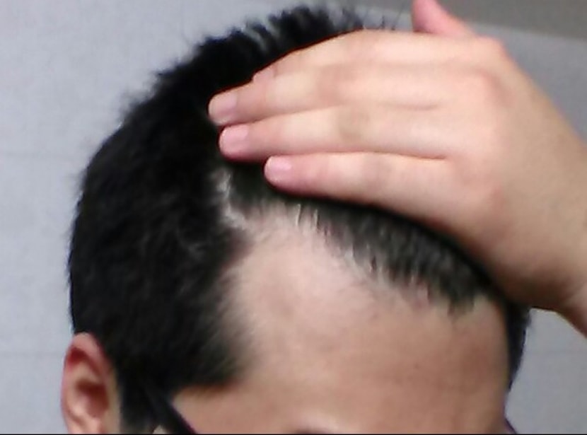 ㅜㅜ어떡해