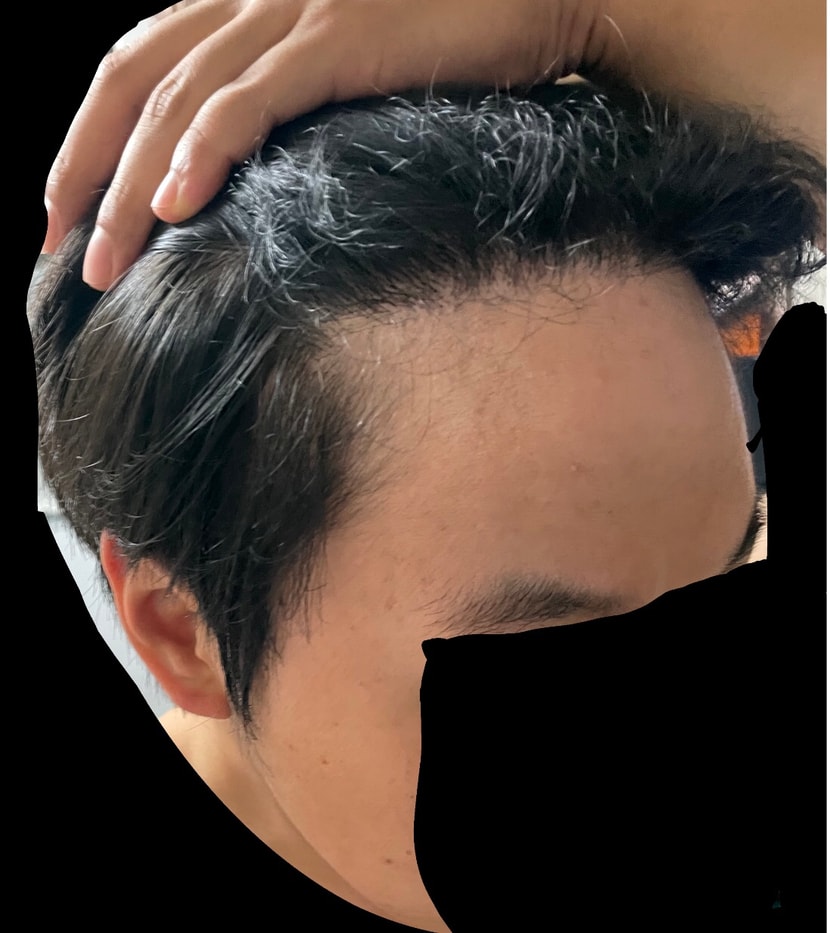 6개월차 - 1