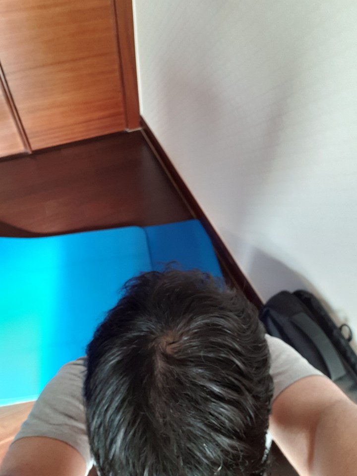 정수리 부분 숱이 없어지는건 이미 알고 있는데.... 