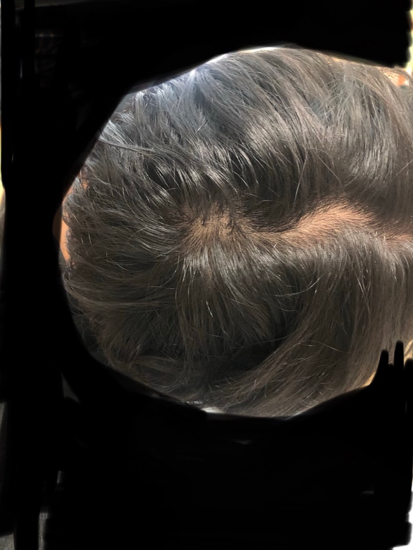 복용 중