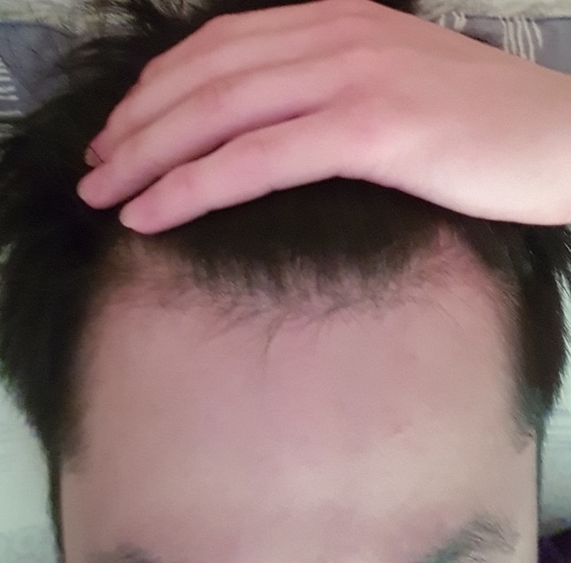 M자 반년전