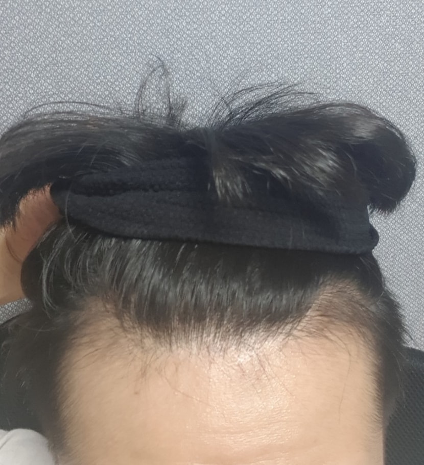 M자 최근