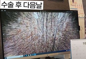 유튜브 하루차 다른 사람 사진