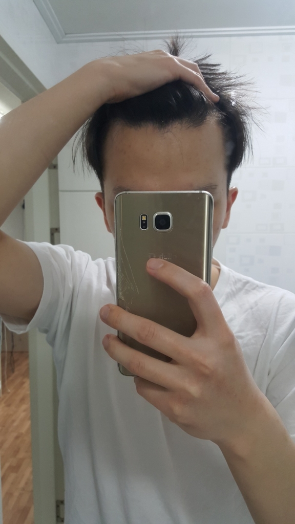 머리를 깠을때