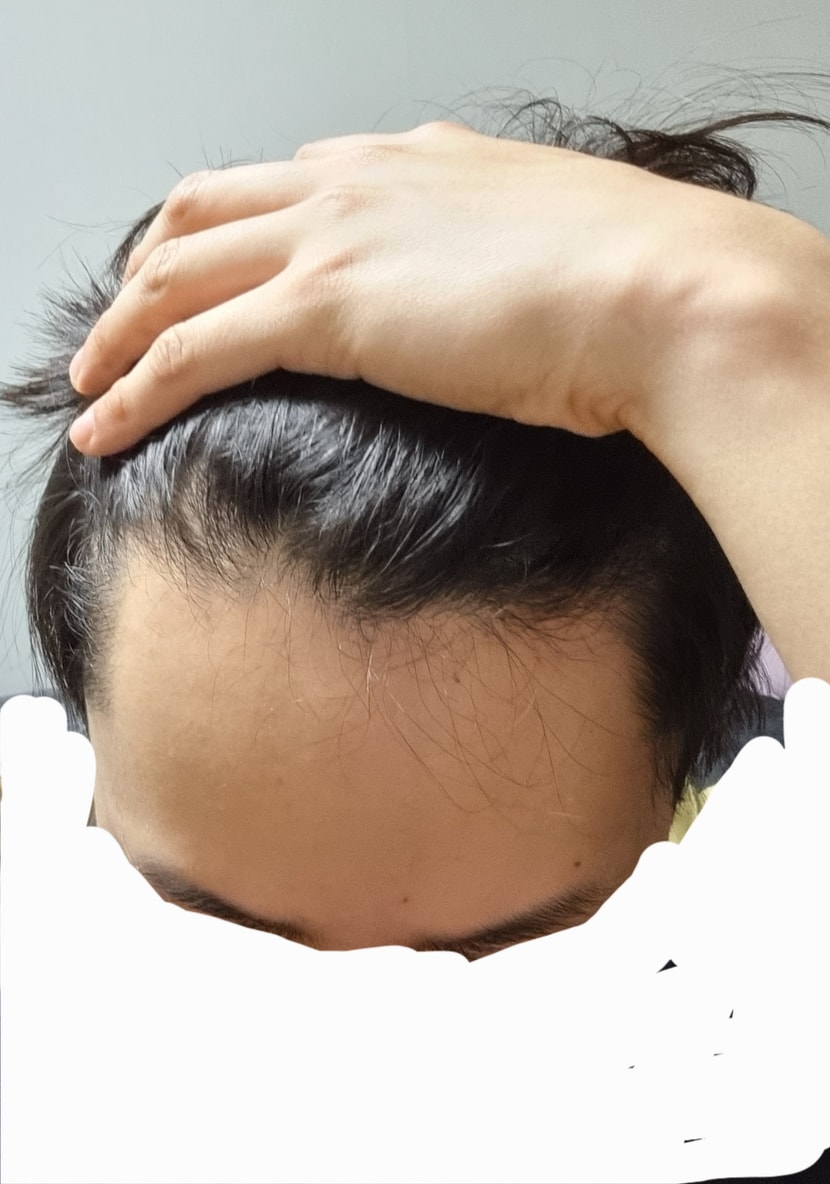 현재1