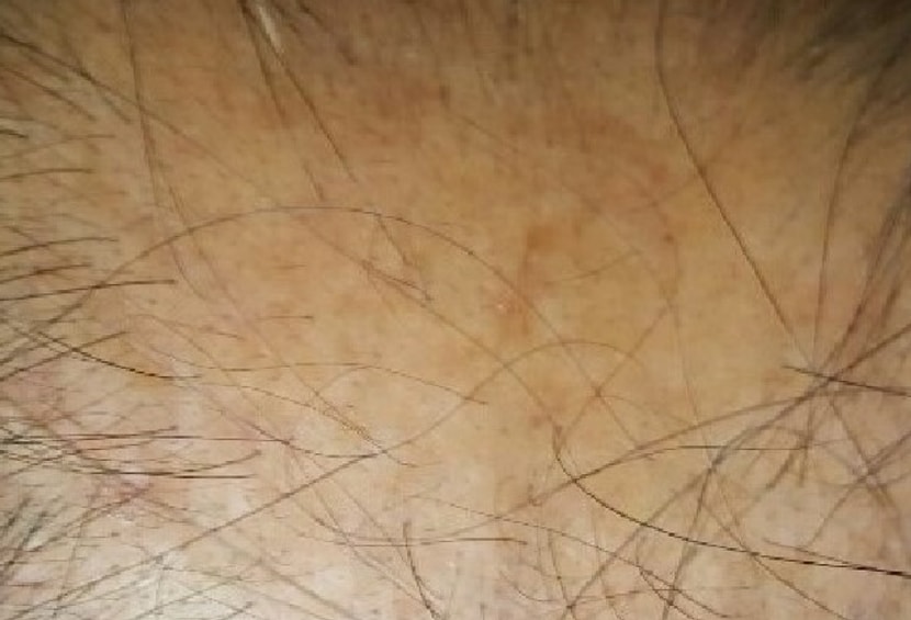 바르기 전 사진 부분 확대