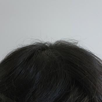 현재 정수리 