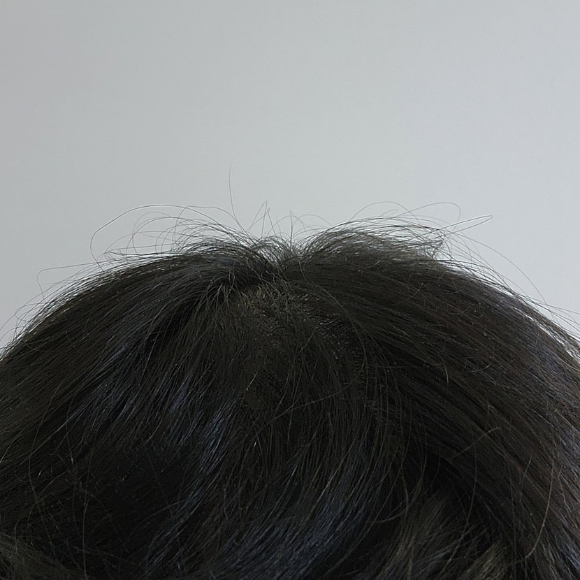 현재 정수리 