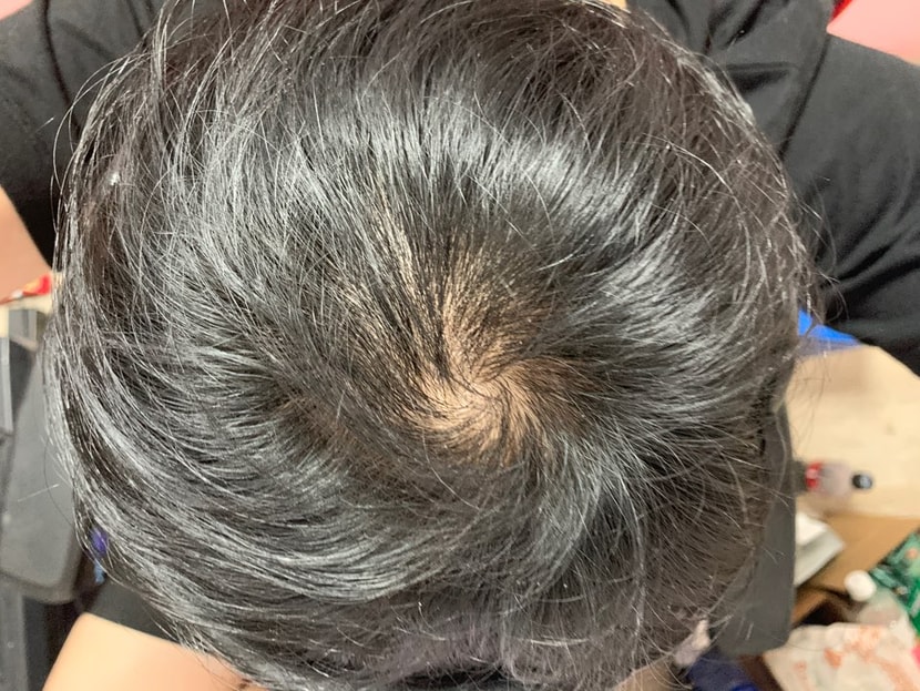 3개월뒤