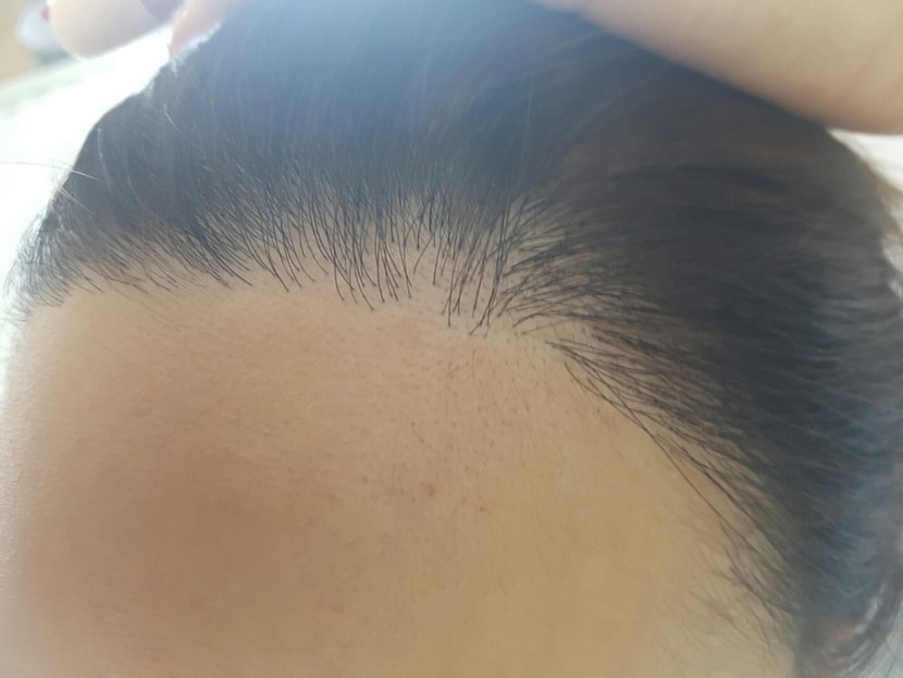 부작용맞나요... 원래 이런건가요?