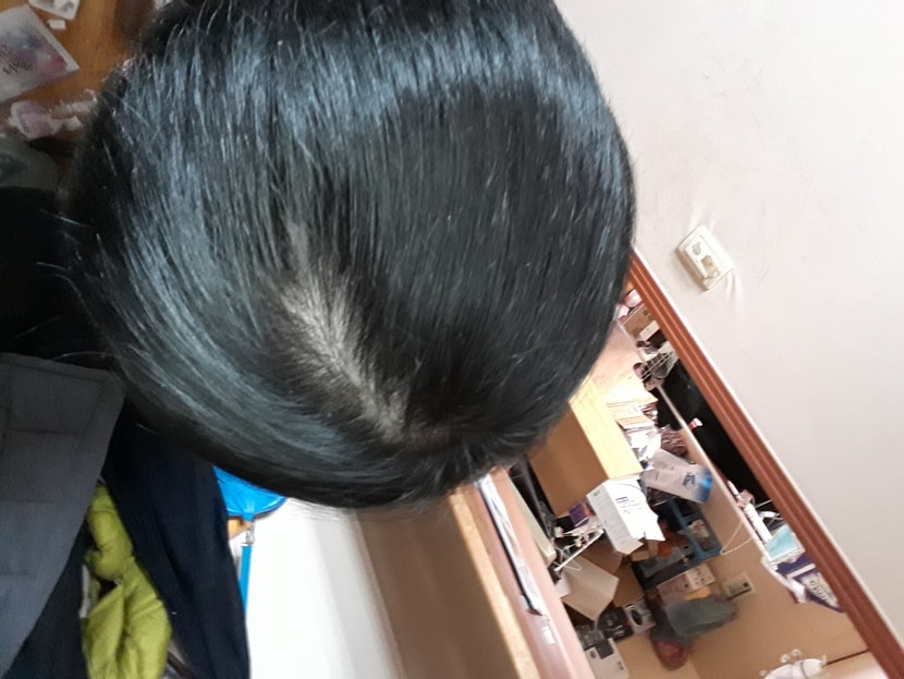근데 뒷머리를 찍으니 이렇게 보이더군요 