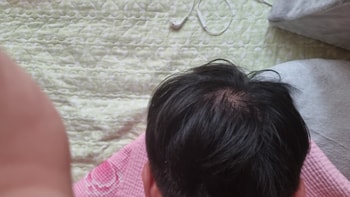뒤통수