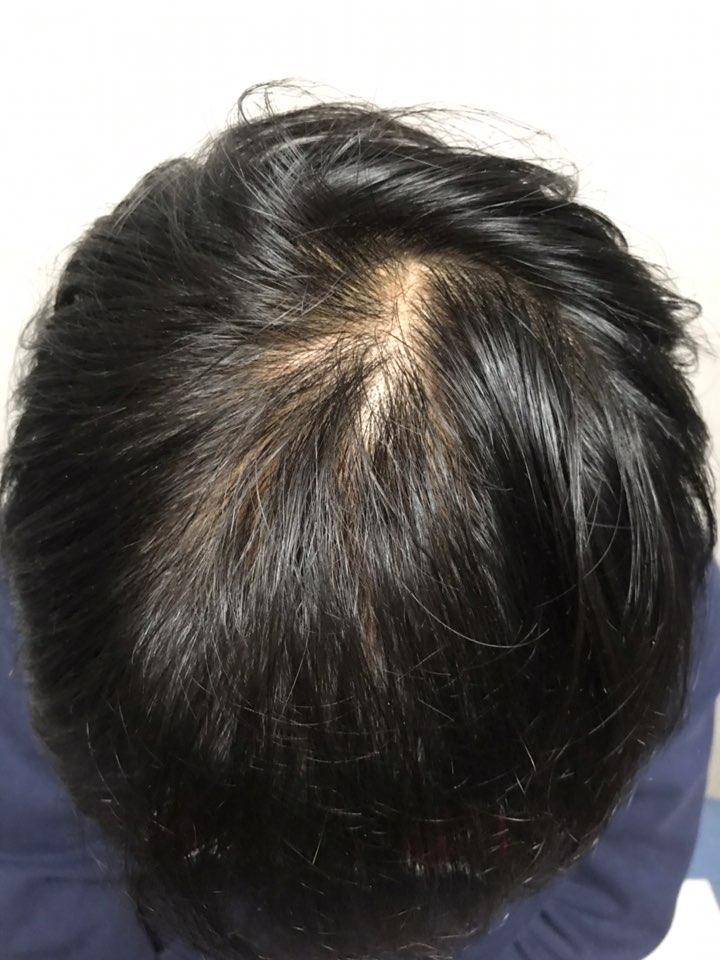 수술전