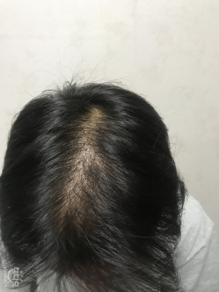 1달차