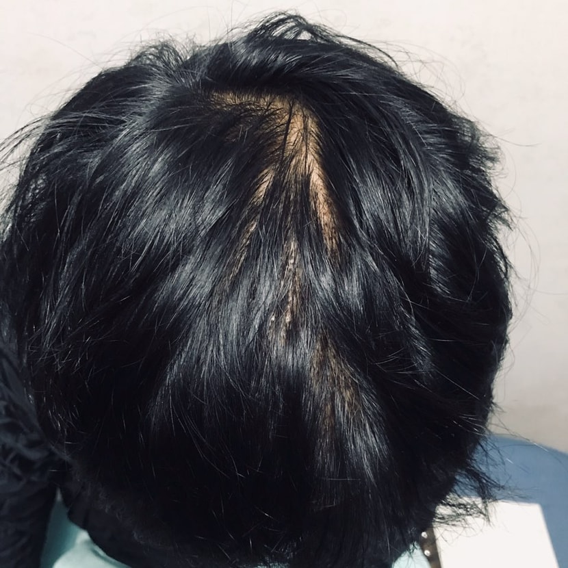 7일차