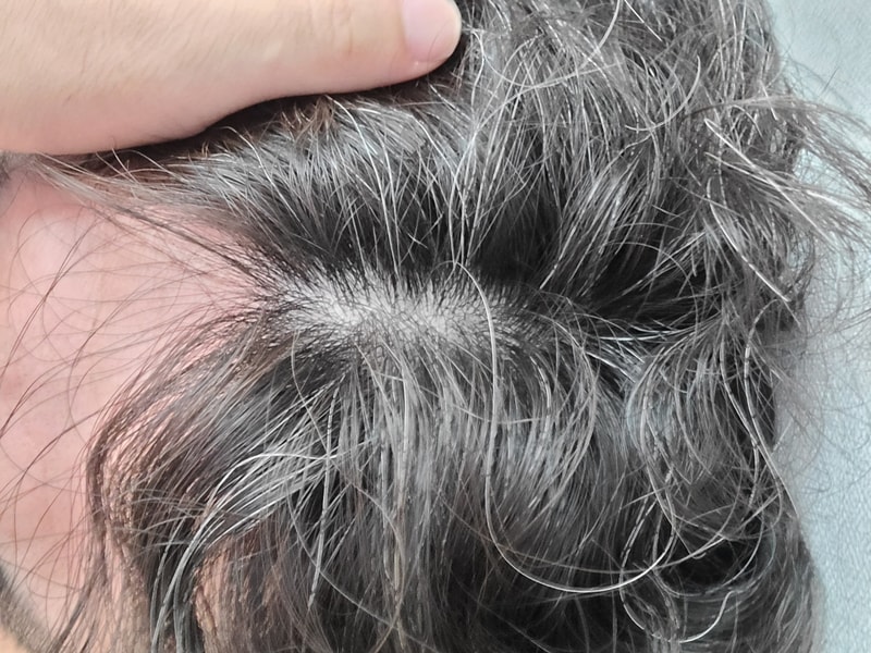 I'm going to take this as a last resort