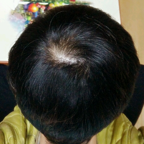 약 먹기 전 12월 말 경